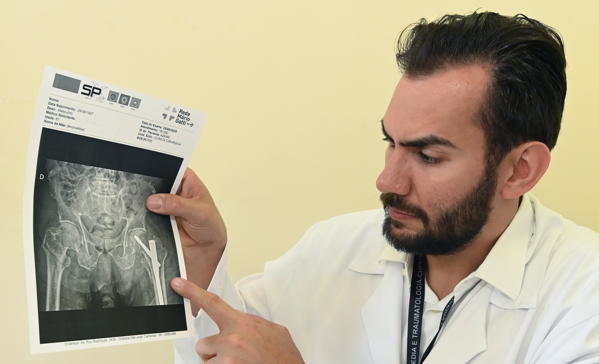 O coordenador de Ortopedia do Hospital Ouro Verde, Leonardo Salani Jacob, disse que a prevenção é a maneira mais eficaz de reduzir os riscos