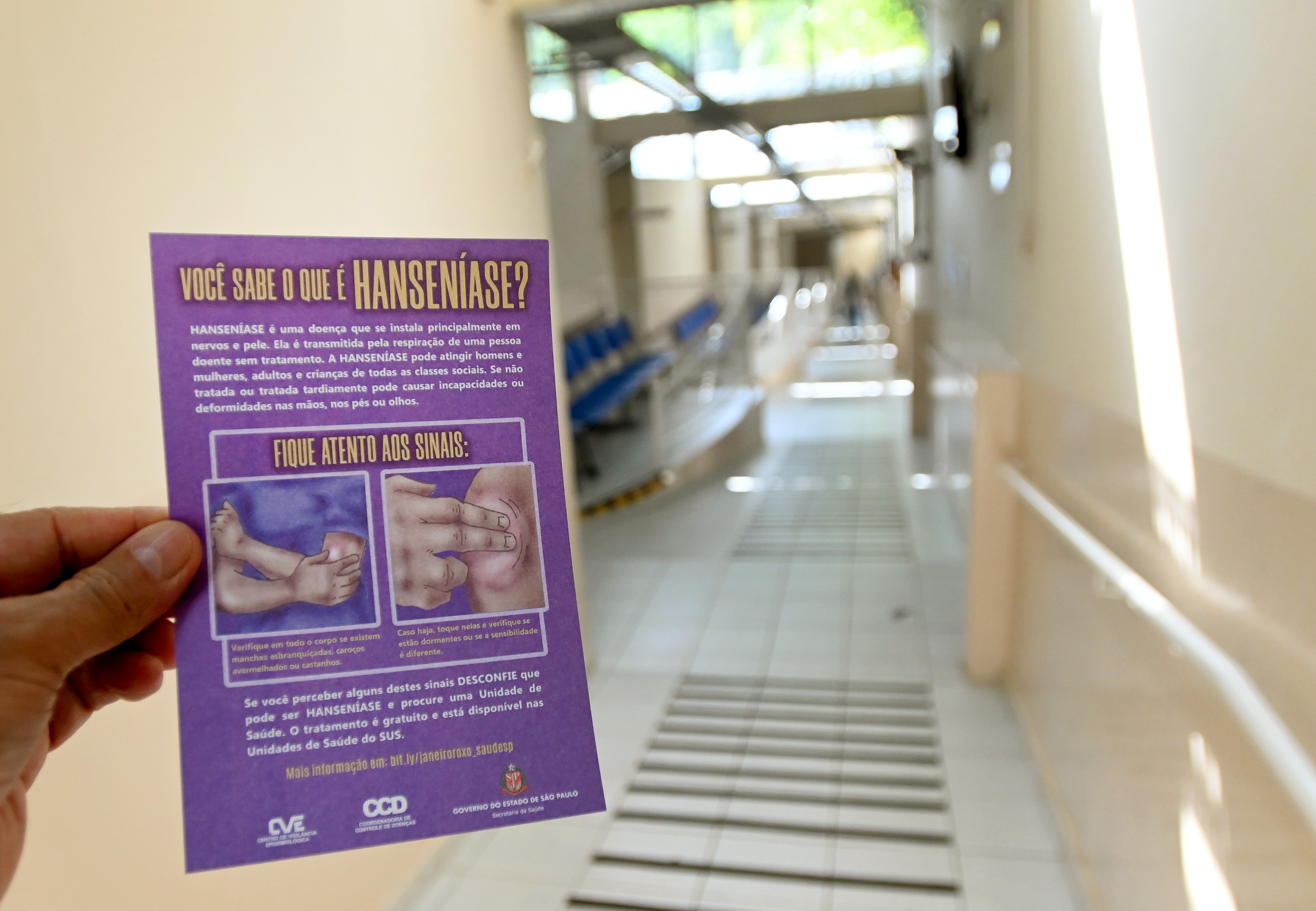 Os Centros de Saúde do município estão disponíveis para fazer o diagnóstico da hanseníase