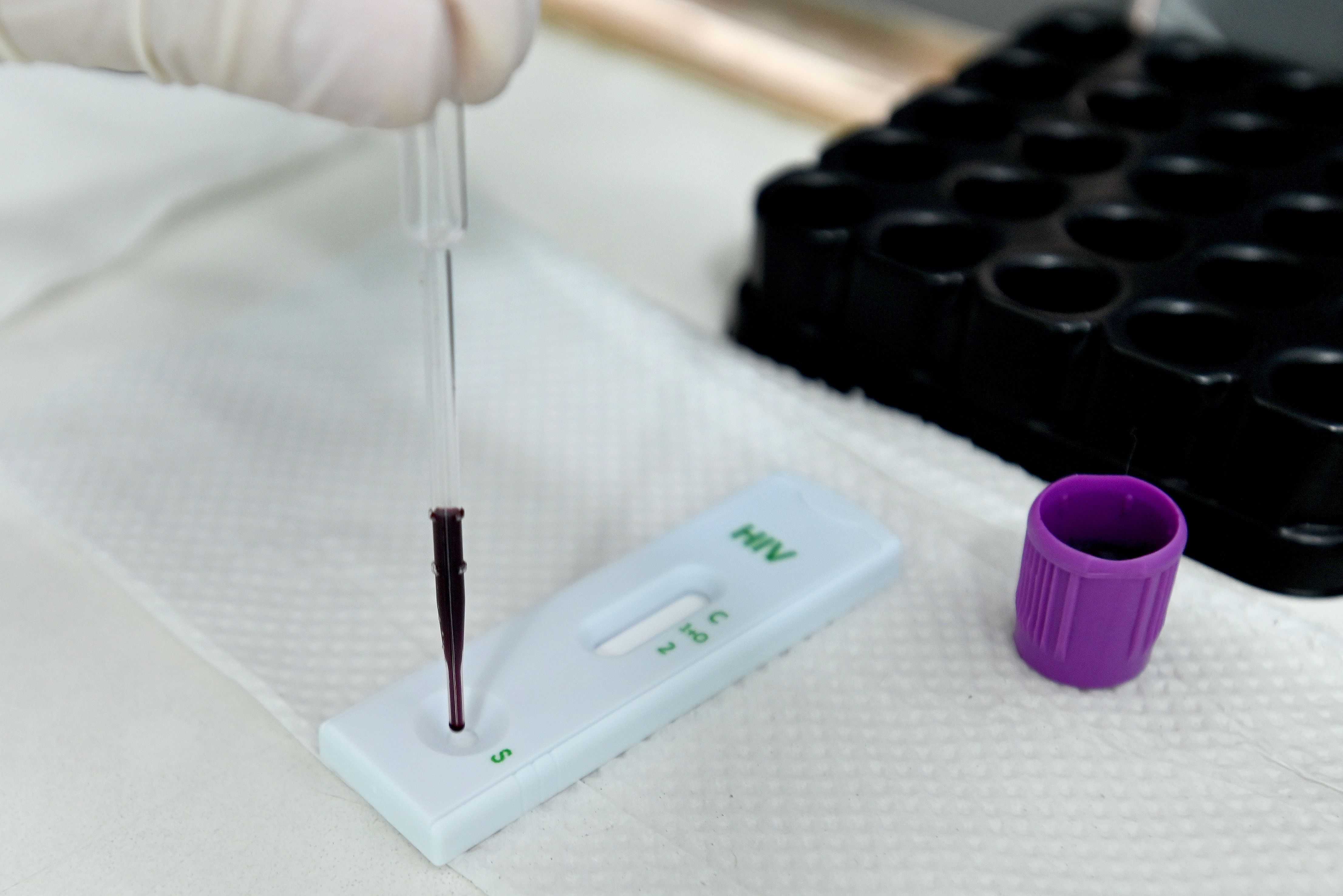 Quando pessoas portadoras do HIV não realizam o tratamento elas podem desenvolver Aids