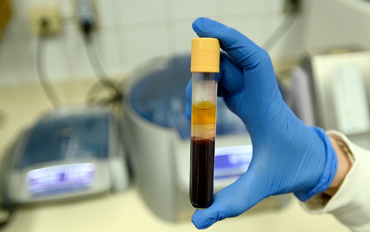 Sangue doado a hospitais de Campinas beneficia 4,5 mil pacientes por ano